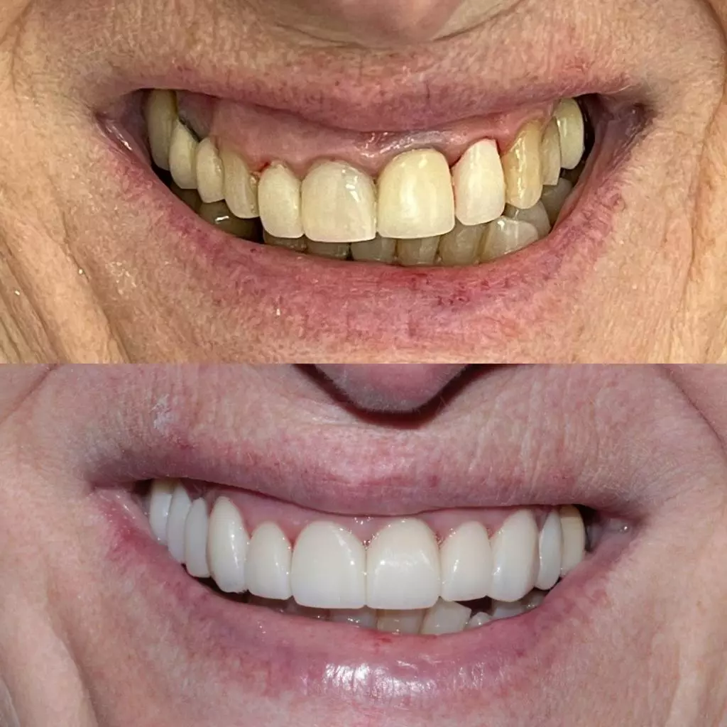 reabilita195167195163o02