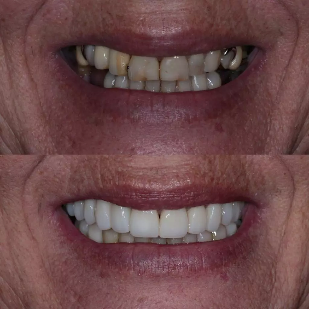 reabilita195167195163o03