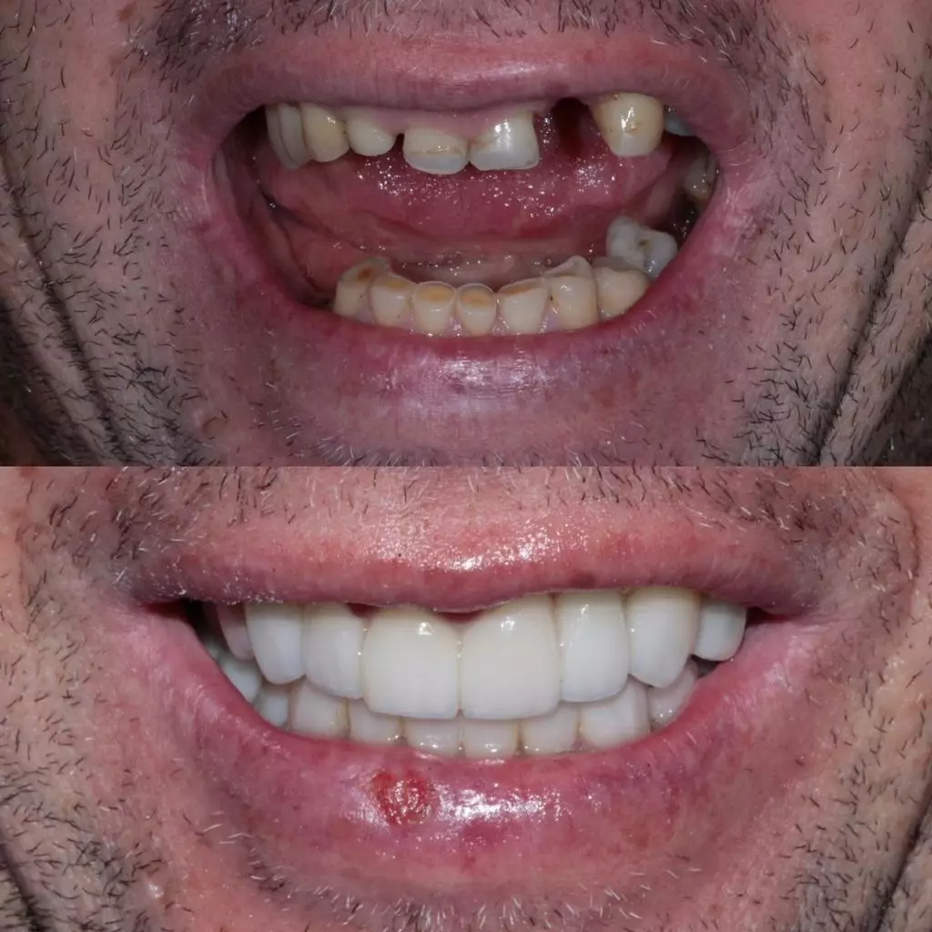 reabilita195167195163o04
