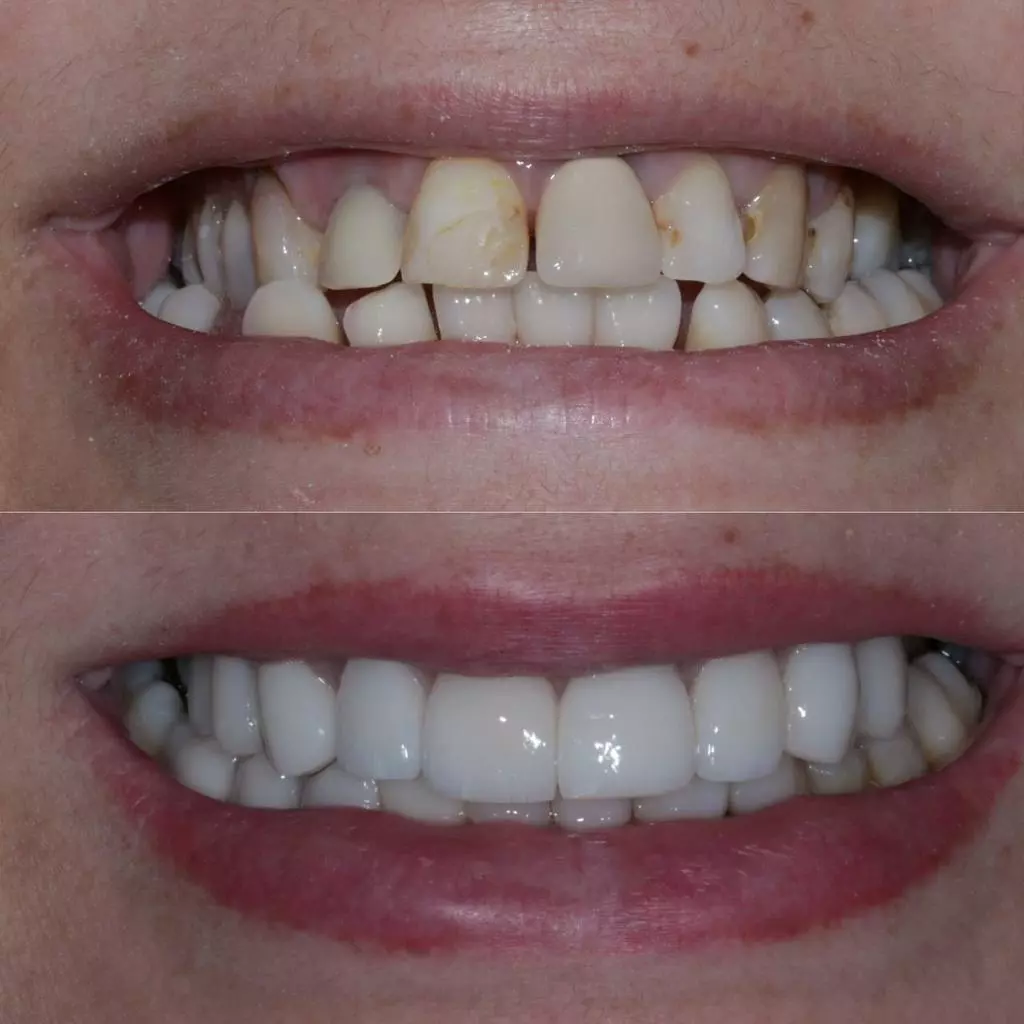 reabilita195167195163o05