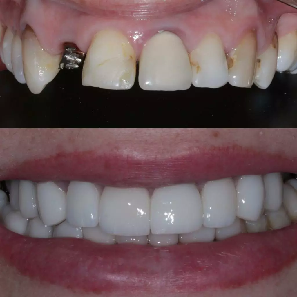 reabilita195167195163o06