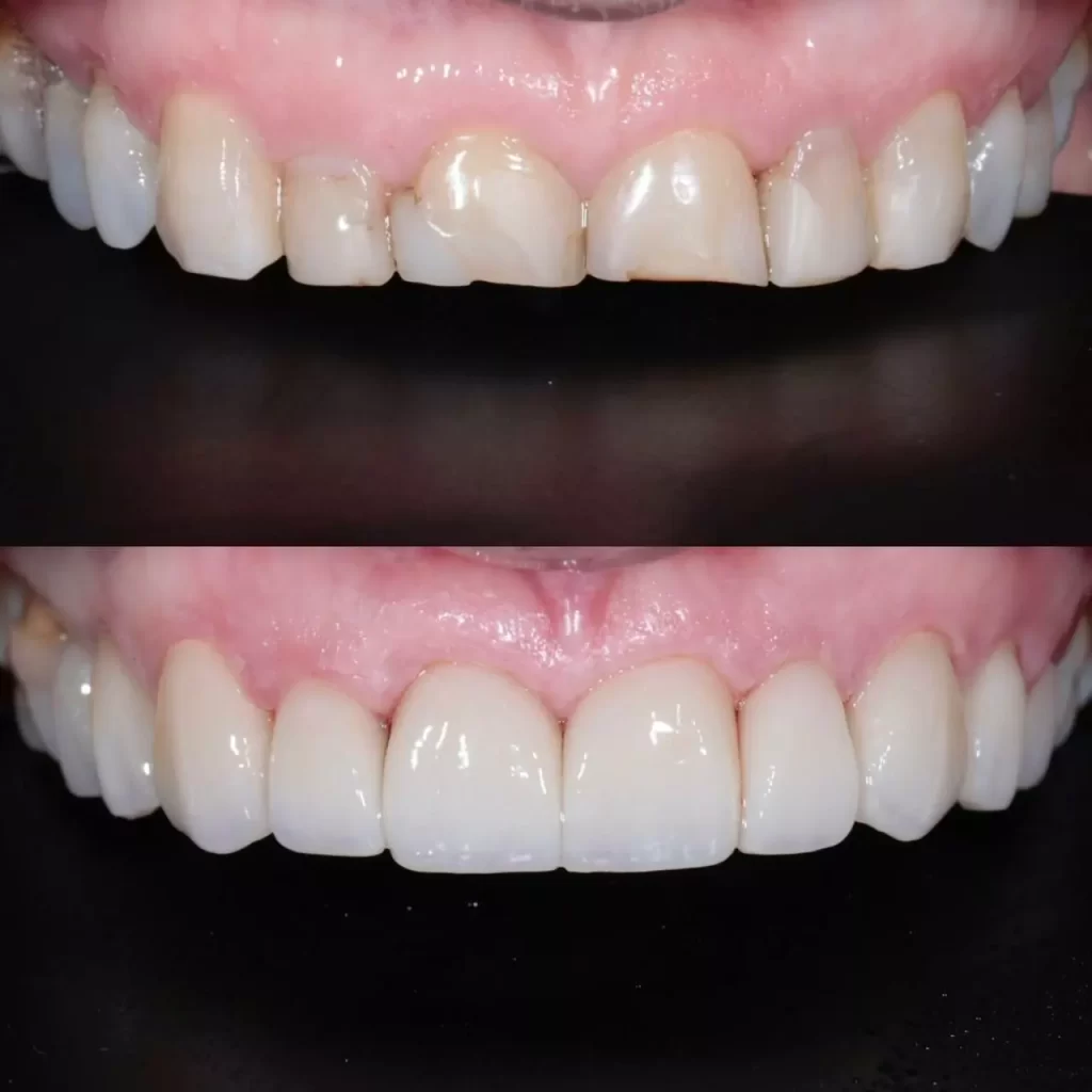 reabilita195167195163o08