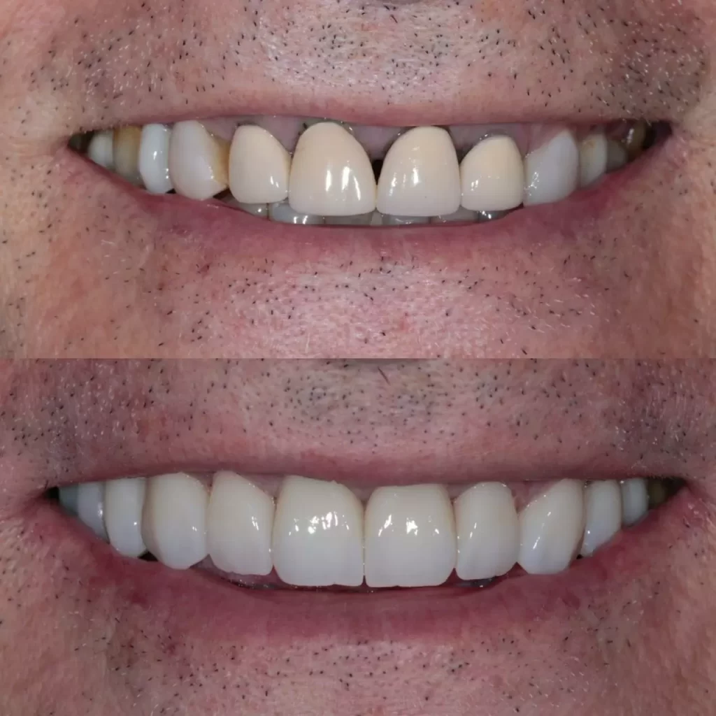 reabilita195167195163o09