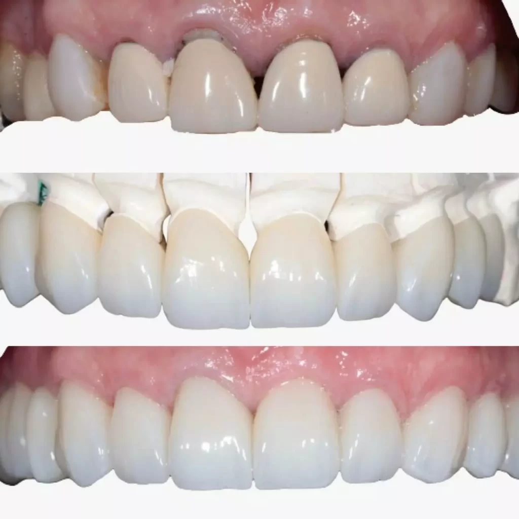 reabilita195167195163o10