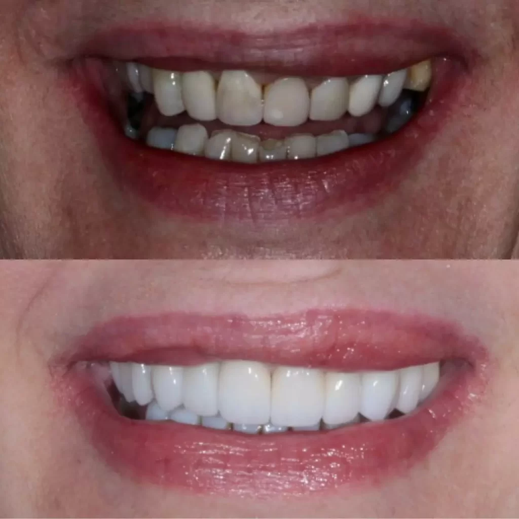 reabilita195167195163o11