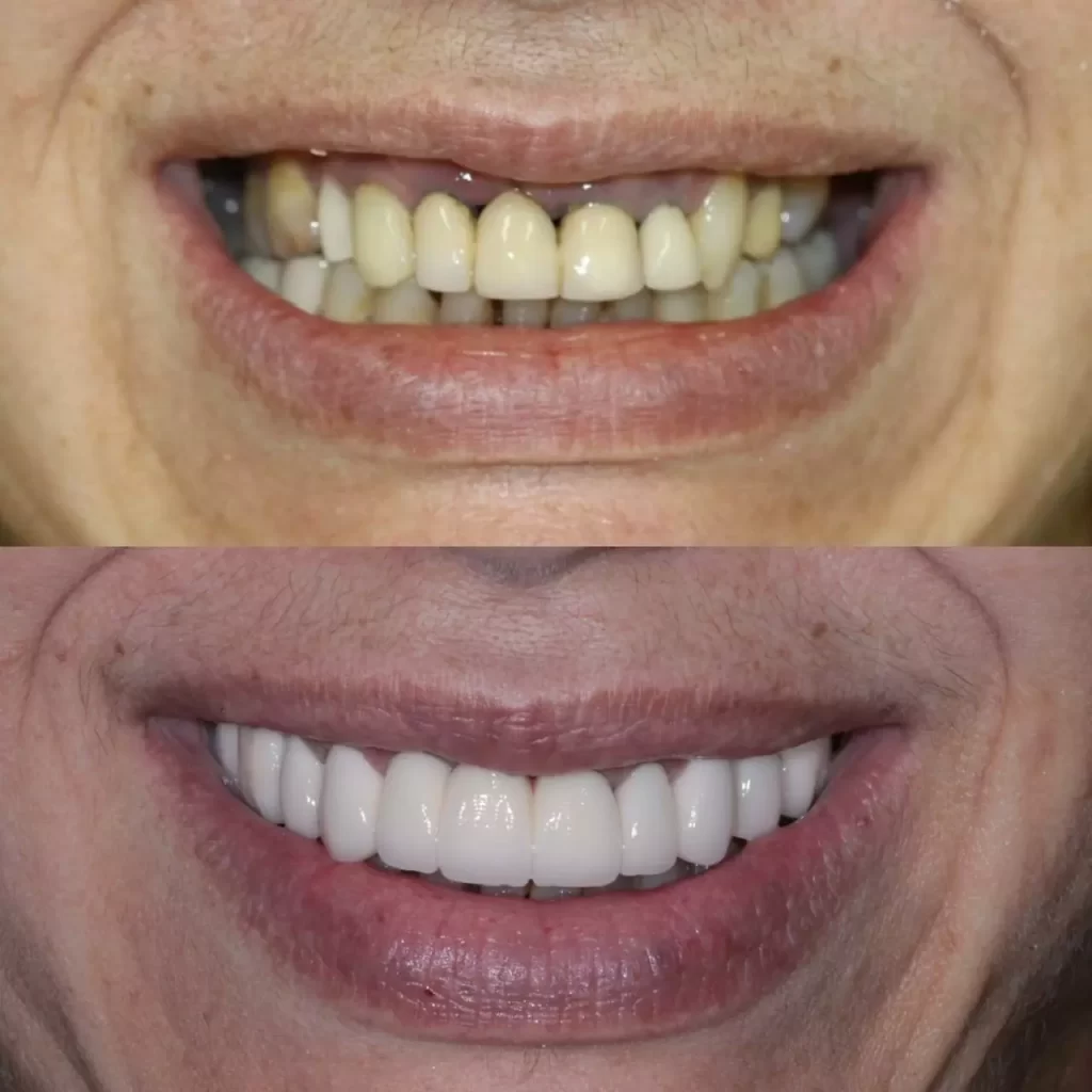 reabilita195167195163o12