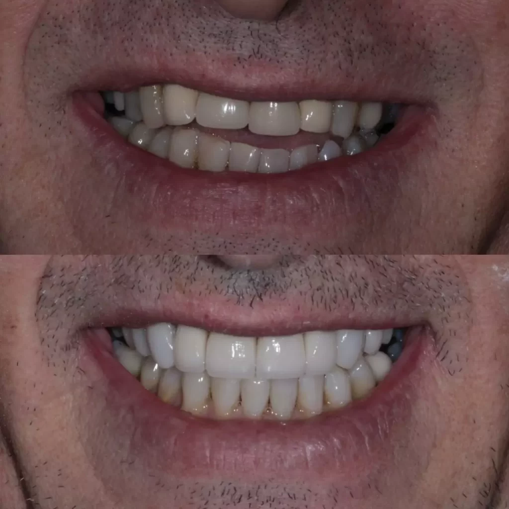 reabilita195167195163o13